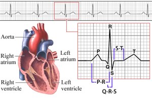 Ekg2